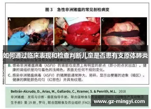 如何通过临床表现和检查判断儿童是否患有支原体肺炎 如何通过临床表现和检查判断儿童是否患有支原体肺炎